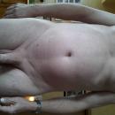2 Bilder
