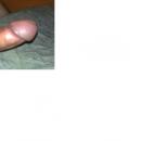 1 Bilder