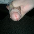 3 Bilder