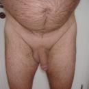 2 Bilder