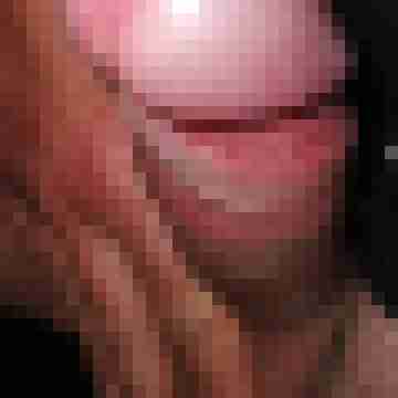 elch72