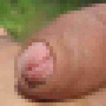 anal-grande