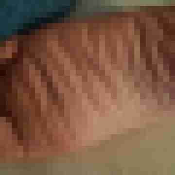 fussficker