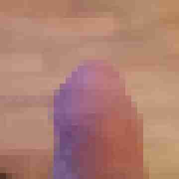 Lupus71
