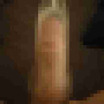 Hot-Igel1