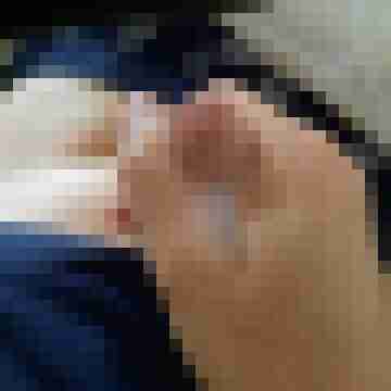 samenein