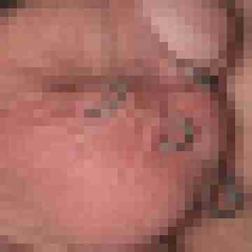Hormonferkel