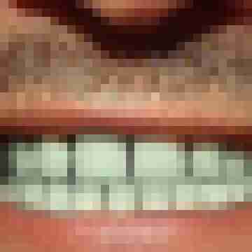 Franky100