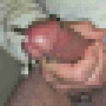 Hormonferkel
