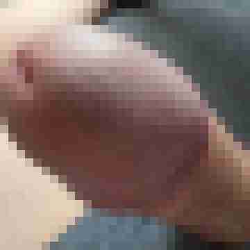 knallschote84