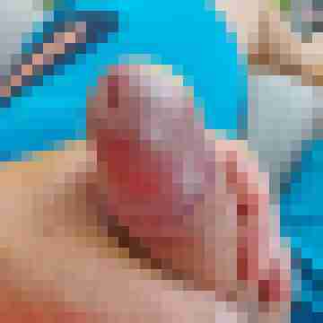 Bi19cmHias