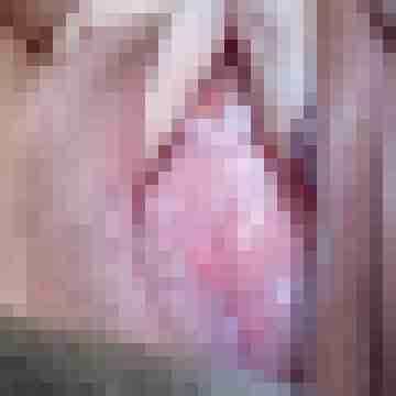 Handicap_Ficke