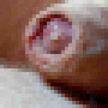 behaartersack