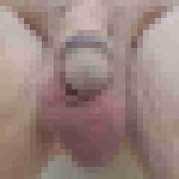 Nassezunge6