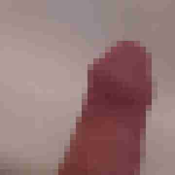 Lupus71