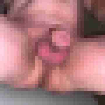 NacktFroschBi