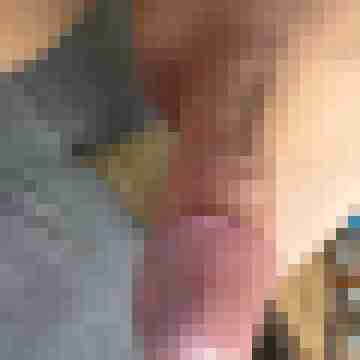 knallschote84