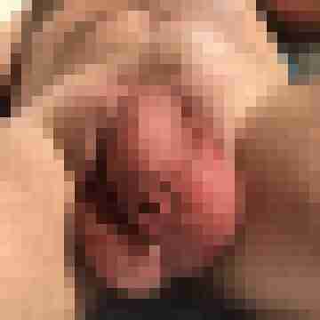 NacktFroschBi