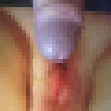 Marc732