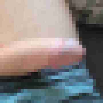 knallschote84