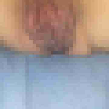 Handicap_Ficke