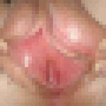 Alextin