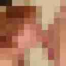 Carlchen