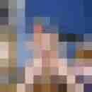 Bare__Glatze