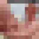 Carlchen