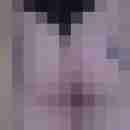 stekel