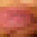 hura