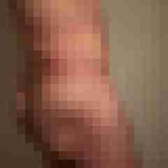 ErOberallg83