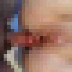 migel1
