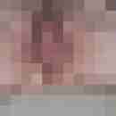 ralle1a