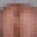 ralle1a