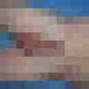 ralle1a