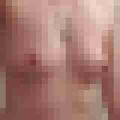 Hot-Igel1