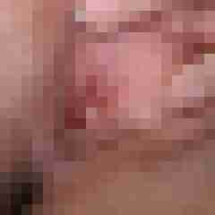 Hot-Igel1
