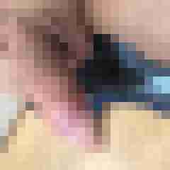 cholp