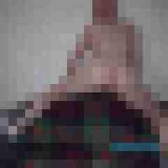 Bare__Glatze