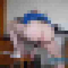 Bare__Glatze