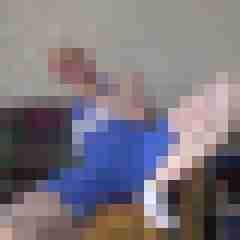 Bare__Glatze