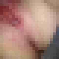 HotFick