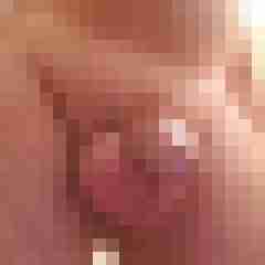 reini9