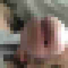 cholp