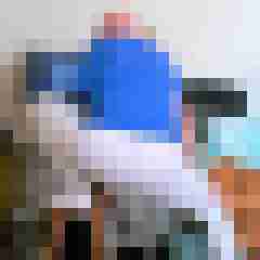 Bare__Glatze