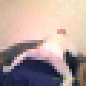 Bare__Glatze