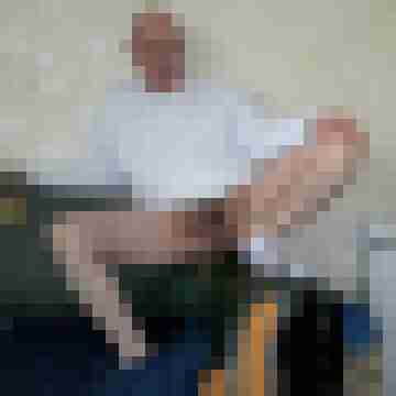Bare__Glatze