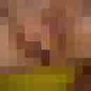 analixx