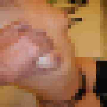 Spekulum